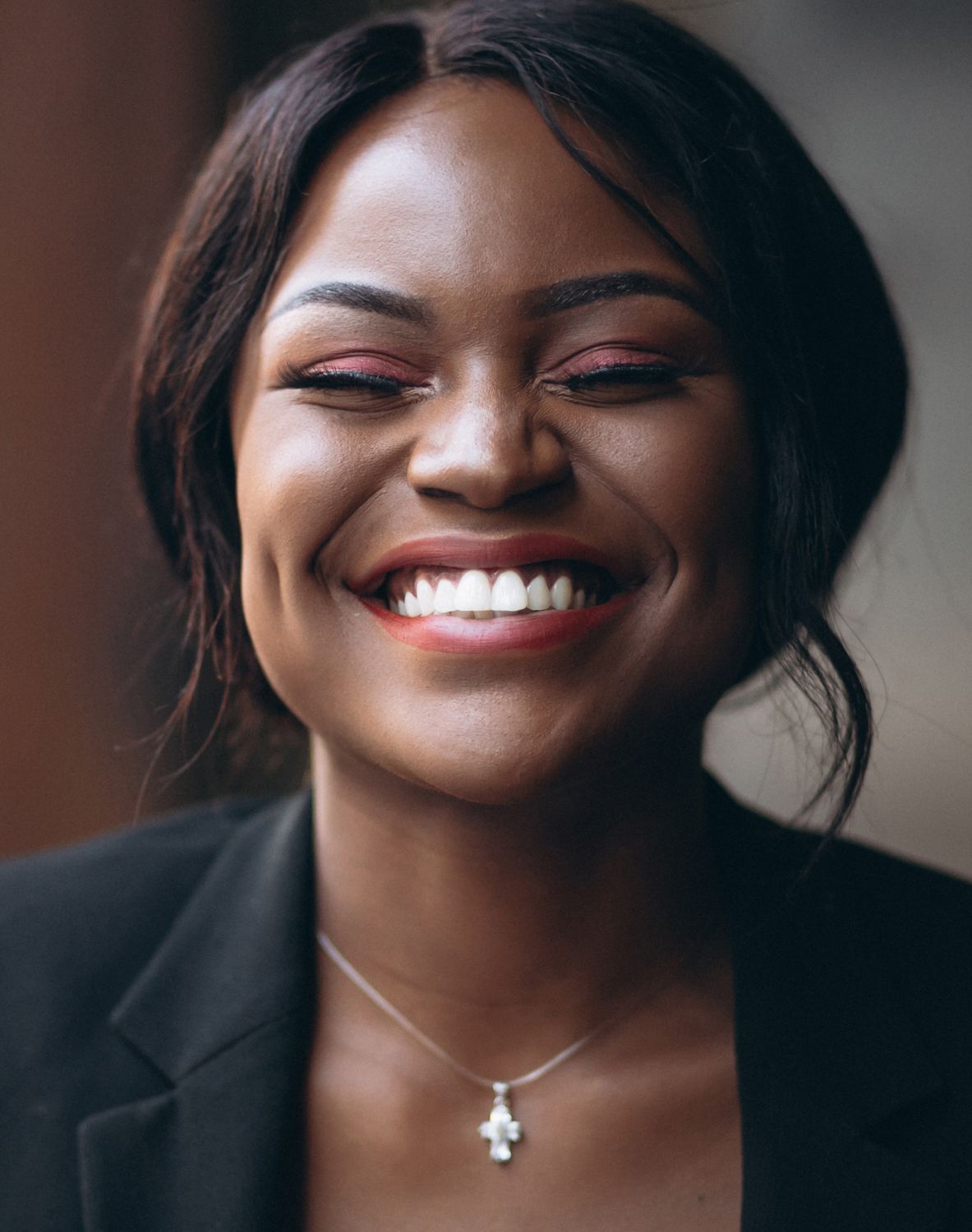 newport beach cosmetic dentistry model 